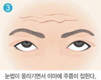 눈썹이 올라기면서 이마에 주름이 잡힌다. 