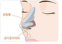 실리콘