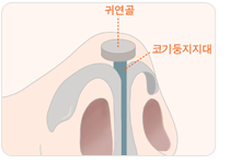 실리콘