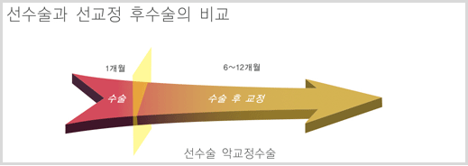 선수술과 선교정 후수술의 비교 그래프