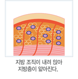 지방 조직이 내려 앉아 지방층이 얇아진다. 